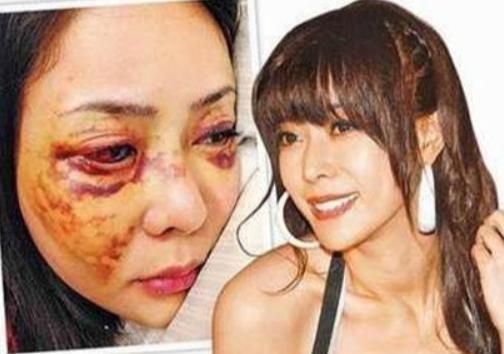 明星被砍,揭秘明星被砍事件背后的真相